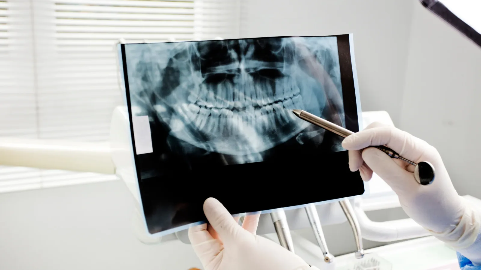 Advanced Dental Radiography